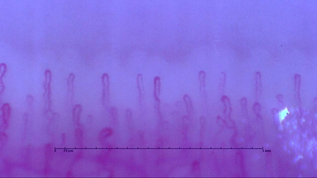 シリカ水 ケイ素 1ヶ月 使用後 血流状態