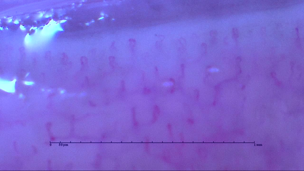 シリカ水 使用前 血流状態