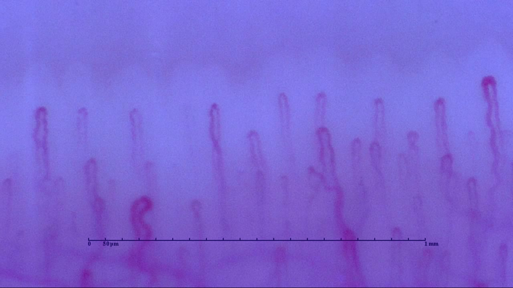 自分の血流 筋トレ後