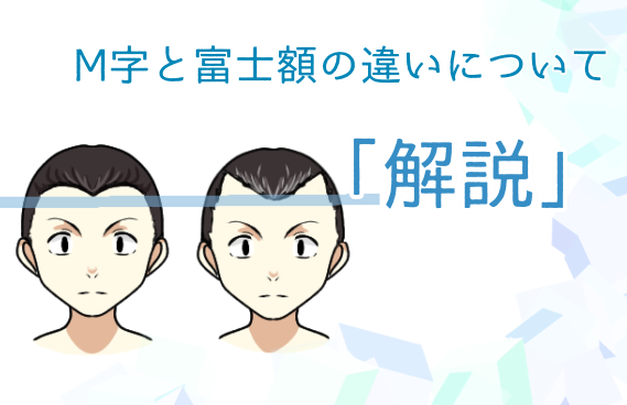 富士額とm字ハゲの違いとは 前髪が富士額だと将来ハゲる確率が高い スーパースカルプ発毛センター吉祥寺駅前店