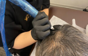 坊主がスカスカに見える場合の対策ヘアタトゥー