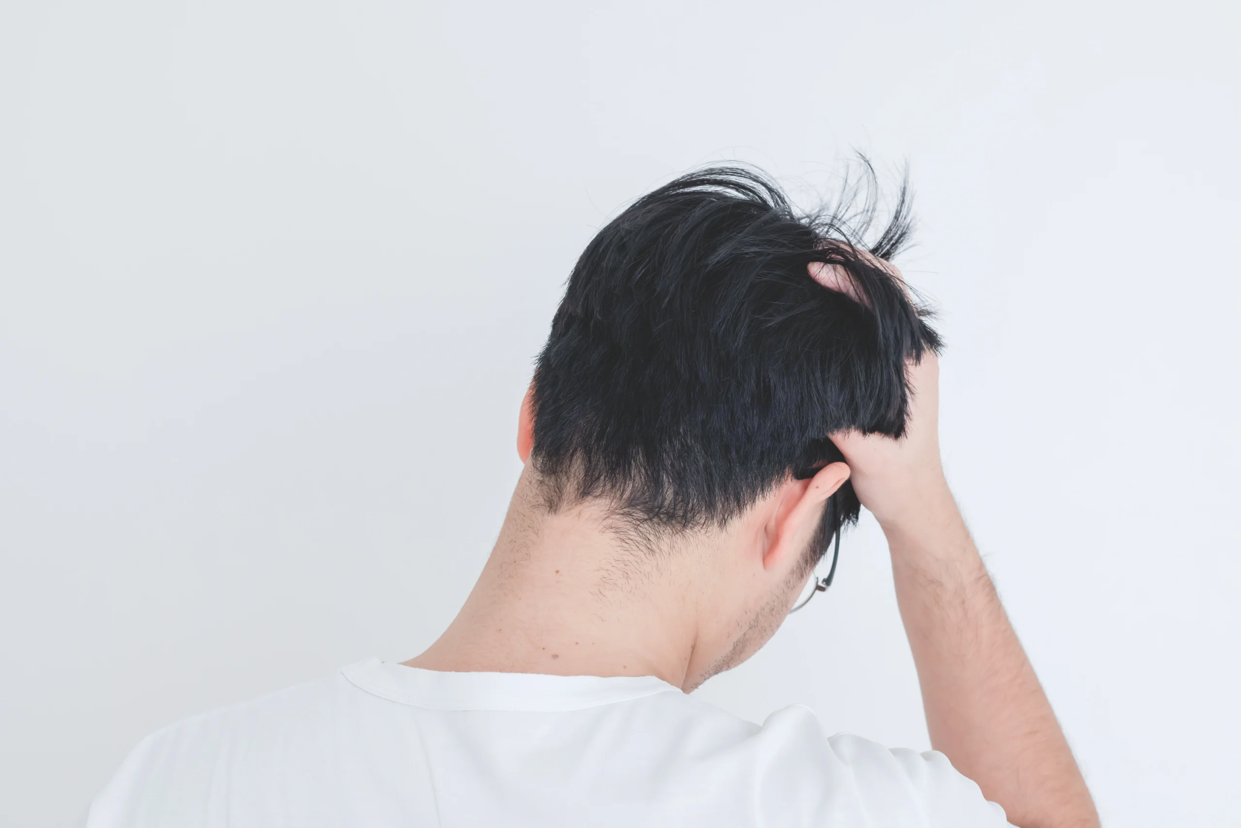 冬の乾燥のフケ