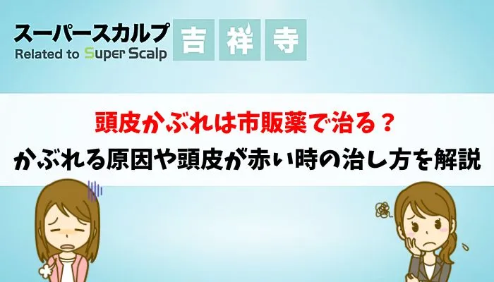 頭皮かぶれは市販薬で治る？かぶれる原因や頭皮が赤い時の治し方を解説